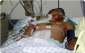 Diabetic Palestinian prisoners rose to 88 patients