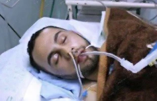 کالبد شکافی توسط سارق اعضا