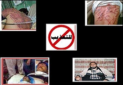 71 Palestinians martyred under Israeli torture