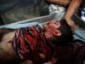 list of 195 people killed in Gaza bloodhsed