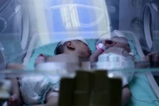 افزایش آمار نوزادان متولد شده در غزه