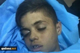 شهادت کودک فلسطینی در قدس
