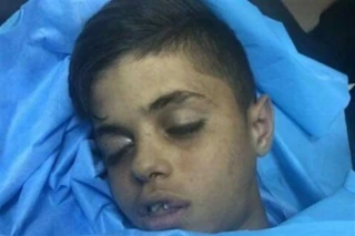 شهادت کودک فلسطینی در قدس
