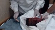 The Israeli new rape in Gaza and the martyrdom of three Palestinian children 11