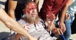 إصابات واعتقالات وسحل نساء على بوابات المسجد الأقصى 2