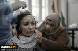 Gaza girl dons 3D-printed mask to heal burnt face