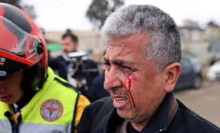 AP photographer beaten by Israeli police in east Jerusalem