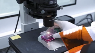 Israel confirms 1st case of monkeypox