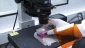 Israel confirms 1st case of monkeypox