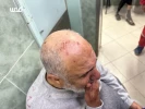 آثار شکنجه بر بدن اسرای فلسطینی 

 4