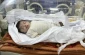 UNICEF warns malnutrition-related deaths in Gaza would ‘skyrocket’ if nutrition crisis not resolved