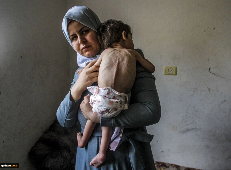 Pregnant women, newborns in Gaza face severe malnutrition 2