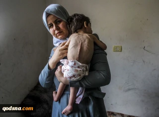 صندوق ملل متحد اعلام کرد؛

زنان باردار و نوزادان غزه با خطر جدی سوء تغذیه مواجه هستند