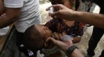 آنروا: تأخیر در آتش‌بس غزه خطر شیوع فلج اطفال را افزایش می‌دهد 2