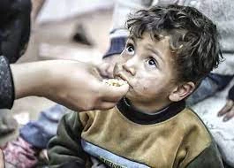 شهادت کودک فلسطینی بر اثر سوء تغذیه