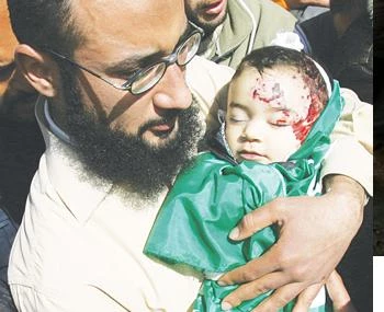 خمسة واربعون شهیدا وأکثر من 140 جریحا