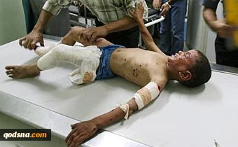 سبعة شهداء و51 مصابا شمال غزة