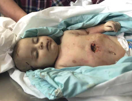 اقتراح إیران : تسمیة الـ 7 من ینایر بیوم غزة