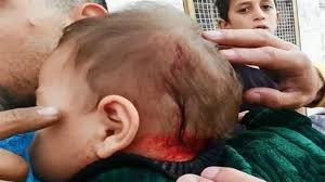 Palestinian toddler suffers head injury after Israeli settlers attack al-Khalil in West Bank