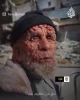 ابتلای یک چهارم اسرای فلسطینی به بیماری‌های پوستی 2