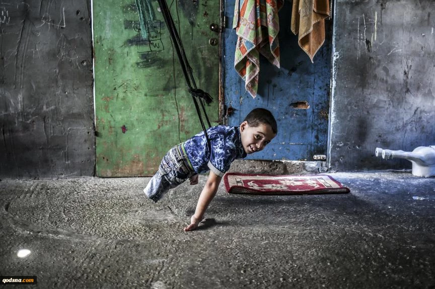 گزارش تکان دهنده وزارت بهداشت فلسطین از تعداد قطع عضو در نوار غزه/ چهار هزار و ۵۰۰ مورد قطع عضو 2