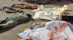 شهادت بیش از ۱۰۰ فلسطینی در نوار غزه ظرف ۲۴ ساعت گذشته 2