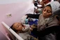 افزایش بی‌سابقه موارد فلج عضلانی حاد در غزه 2