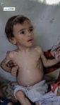 شهادت ۱۲۷ نفر از جمله ۸۵ کودک بر اثر قحطی در غزه 2