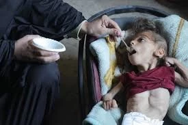 فاجعه انسانی در غزه: ۵۴ هزار کودک زیر پنج سال قربانی سوءتغذیه حاد