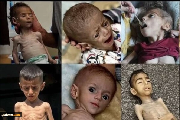 یونیسف: یک میلیون کودک در غزه با گرسنگی و فاجعه روبرو هستند 2