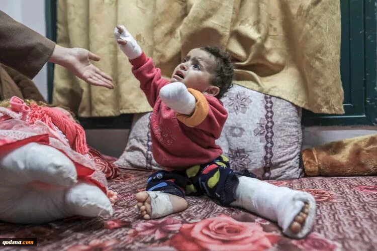 جنایت در سکوت؛ افشای 2 مورد از جنایات وحشیانه صهیونیست‌ها 

دانشگاه آمریکایی بیروت: ثبت بالاترین آمار جهانی در زمینه قطع عضو کودکان در غزه/  رئیس مجتمع پزشکی شفا: اشغالگران از بدن برخی شهدا اعضایی را سرقت کرده‌اند 2