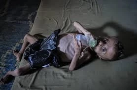 کاهش ۱۱ درصدی موالید و دو برابر شدن مرگ جنین در نوار غزه در سال ۲۰۲۵