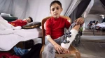 More than 43,000 suffered life-threatening injuries during Israeli genocidal war in Gaza: WHO