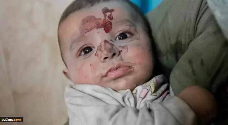 شهادت روزانه 5 فلسطینی در غزه از زمان امضای توافقنامه آتش‌بس