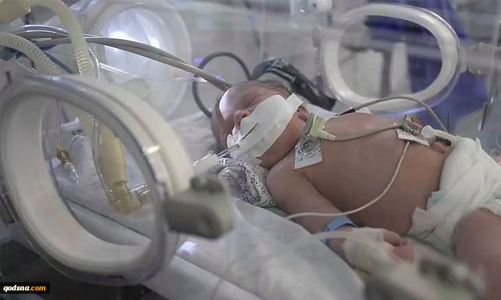 The health ministry has warned of catastrophic consequences as most oxygen generation stations in Gaza hospitals have stopped operating due to Israel’s continued ban on the entry of spare parts and maintenance supplies needed to run them.